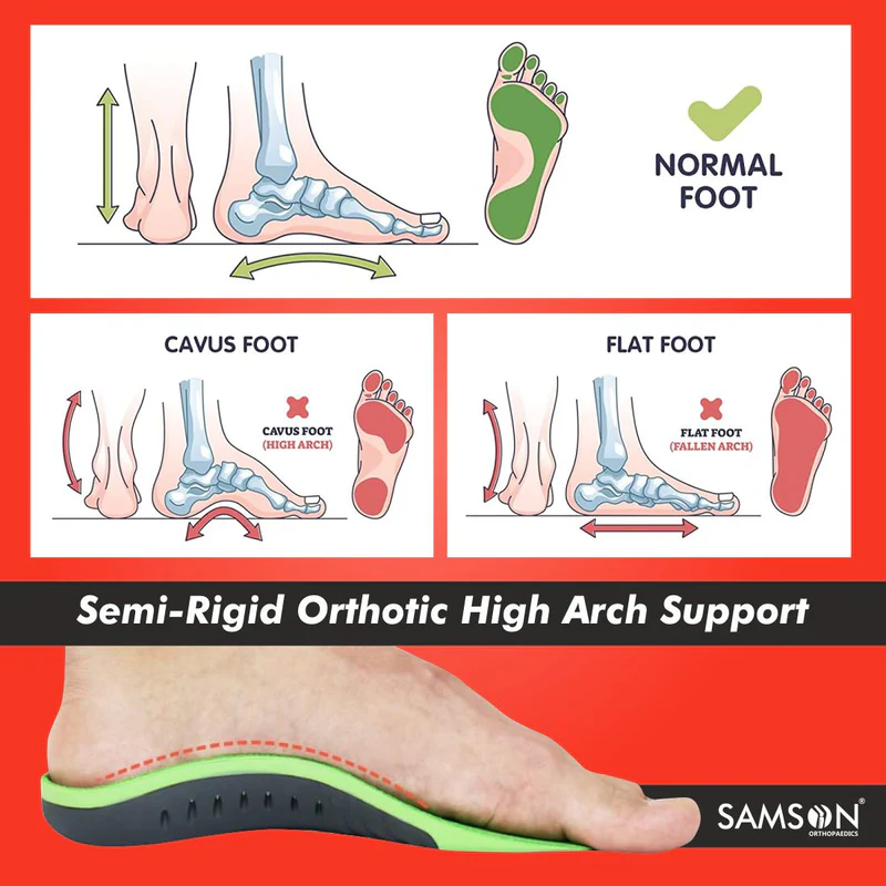 Orthotic Insole with Arch Support